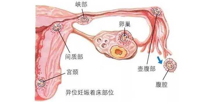 纳雍县52岁供卵成功力有多少_纳雍县44岁供卵怀孕了_试管婴儿着床失败的原因有
