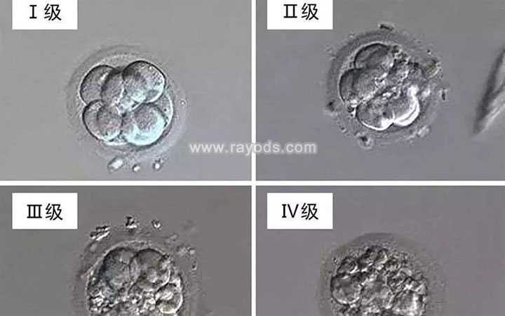代孕有联系方式吗_代孕包成功靠谱吗_二代试管培养的胚胎质量怎么样？等级是